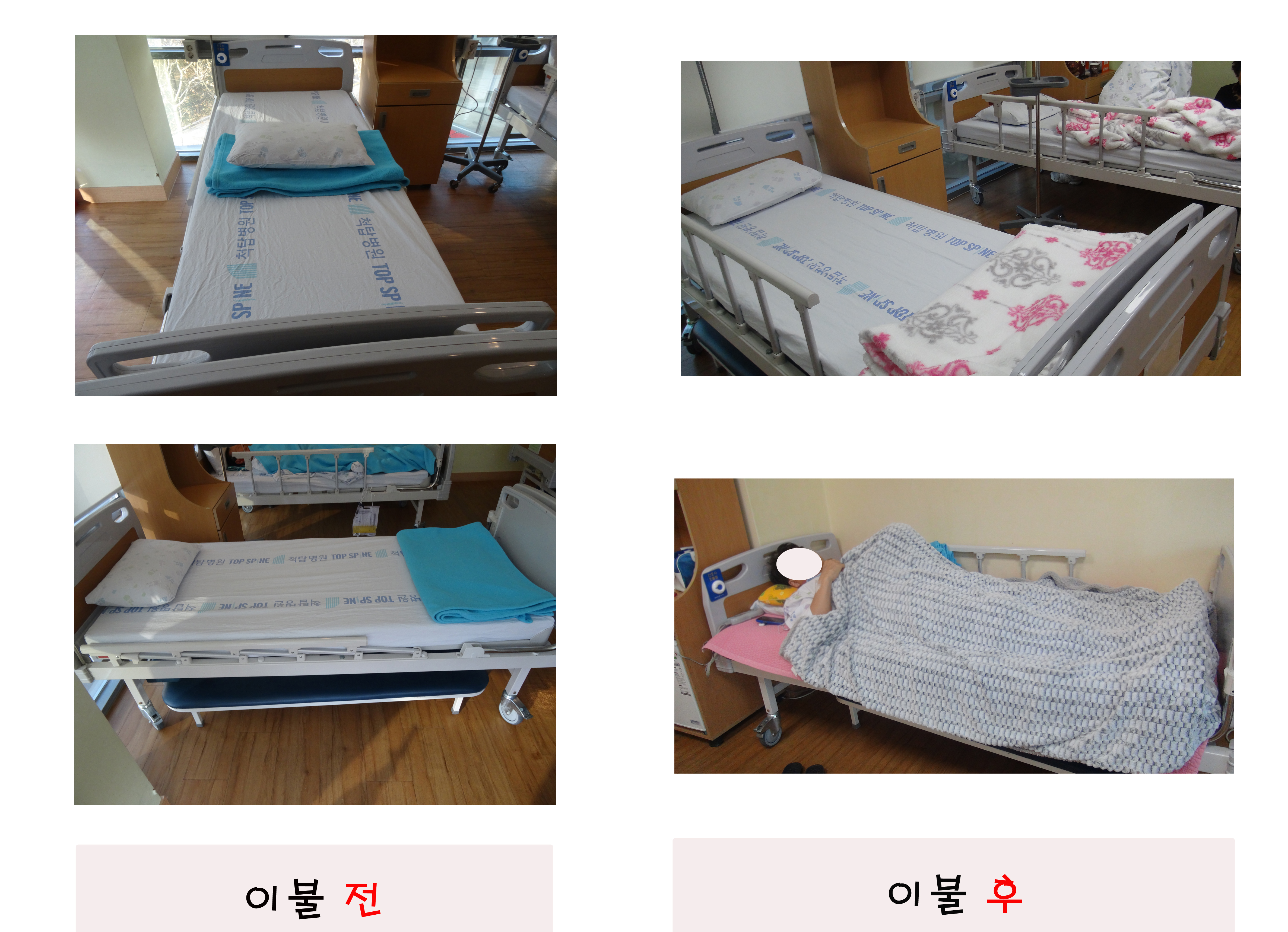 전후사진(수정).jpg